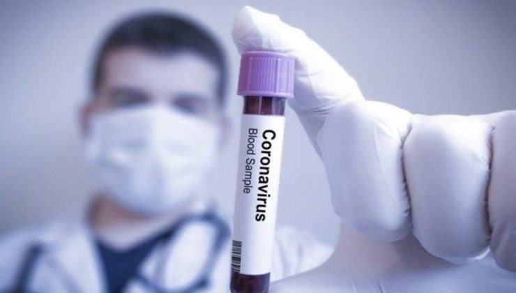Koronavirüs Tedavisinde Yeni Yöntem Türkiye’de