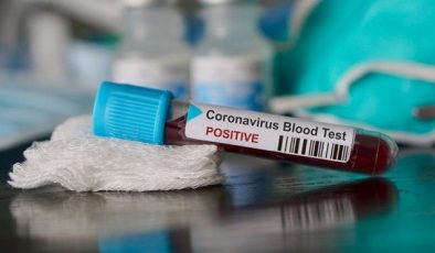 Koronavirüs testi yapılabilecek hastaneler listesi: İstanbul, Ankara İzmir…