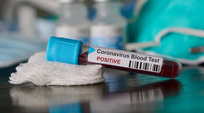 Koronavirüs testi yapılabilecek hastaneler listesi: İstanbul, Ankara İzmir…