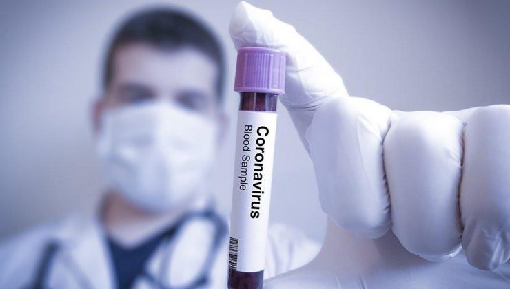 SGK corona virüsü teşhis ve tedavisi hakkında detaylar belli oldu