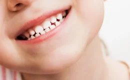 Çocuklarda diş çürüğü neden olur?